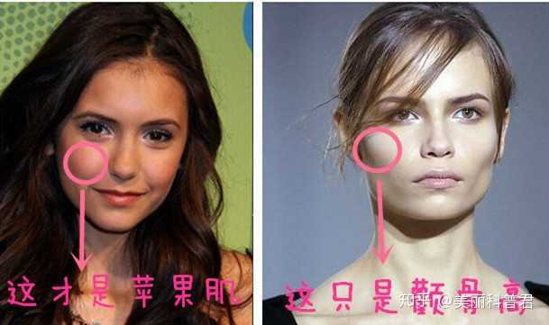 苹果肌饱满是显年轻的标志,而颧骨太突出会有显老的感觉
