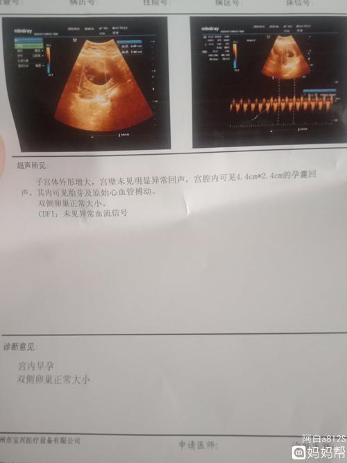 孕八周,能看出来男孩女孩吗?