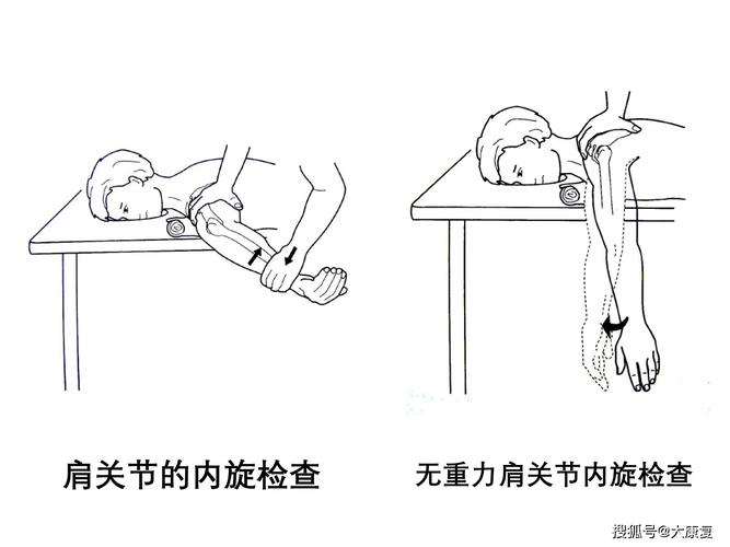 肩关节检查法(全)