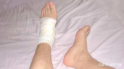 扭伤脚踝这样做帮你迅速恢复