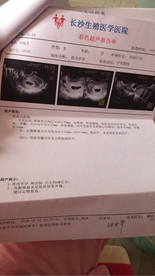 宝妈们有怀孕出现宫腔积血吗