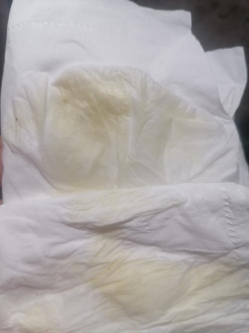 请问这是羊水破了吗孕38 6站起来就流出来我又躺着