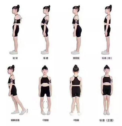 腿型不正?该如何纠正孩子的不良体态?快进来