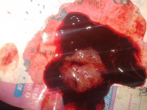 我今天上厕所发现一个小肉球,这是什么东西