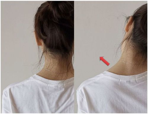 导致的假性斜方肌大,这就是为什么不怎么锻炼的女生,看起来斜方肌比