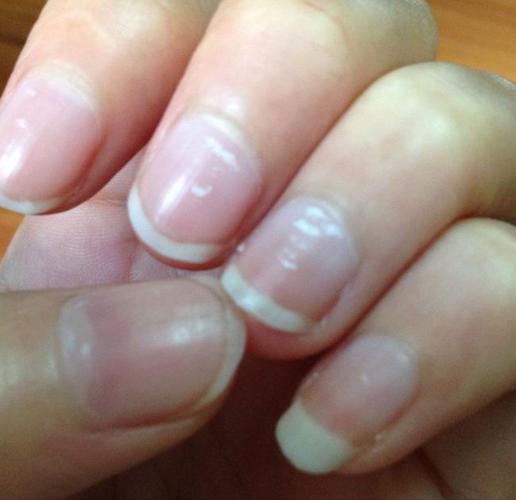 为什么有人指甲上的月牙非常少?还有很多小白点?原因都找到了