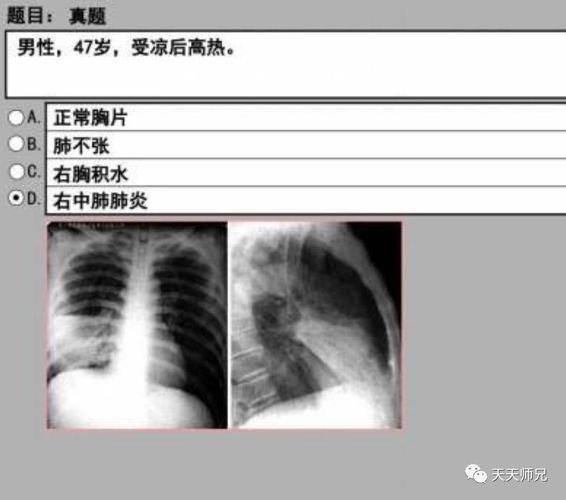执业医师第一考站之影像诊断真题上