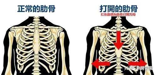 一文看懂"肋骨外翻"的所有概念