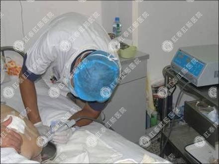 难愈合伤口:如复杂性肛瘘,严重的混合痔,痔脱垂,肛周脓肿等传统方法