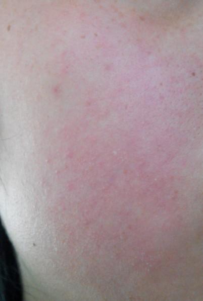 我星期五换的护肤品,星期六中午发现我的脸