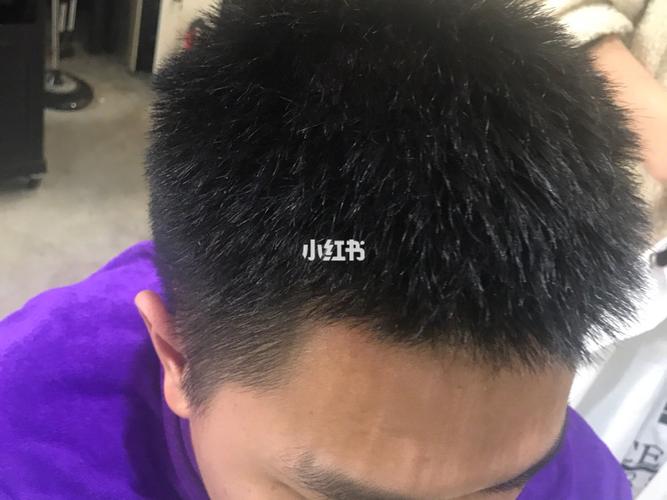 很流行的一种烫发也是一种艺术感 头发最短6厘米可以烫,也是一种技术