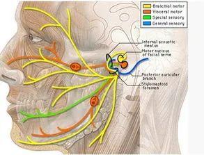 面瘫的早期症状及该如何治疗