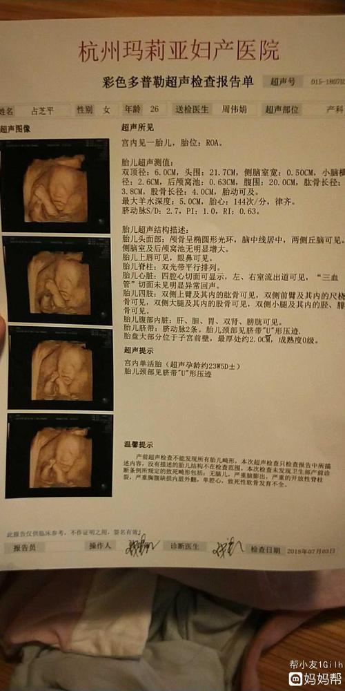 24周 6四维彩超,宝妈们有能看出男女的
