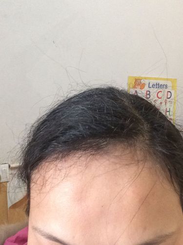 额头有骨包突出的面相