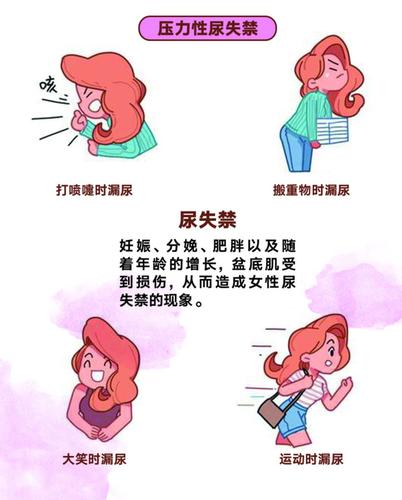 压力性尿失禁——笑尿了,也是一种病