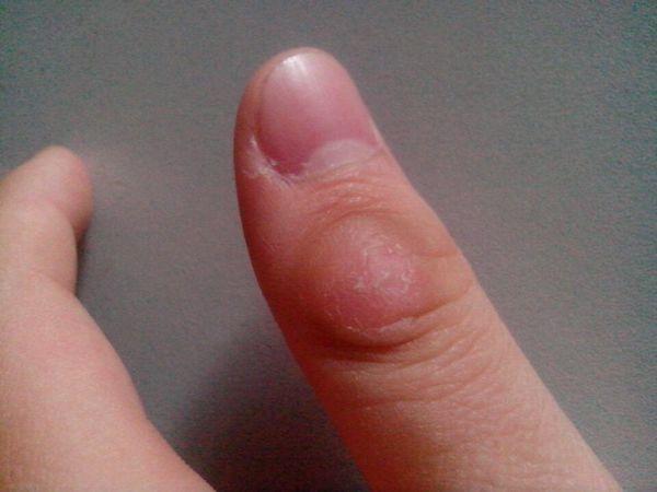 还是皮肤怎么了?附图