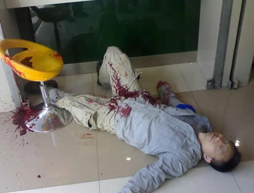 自宫少年,小伙一个月内十次自宫切下睾丸丢床底,只有