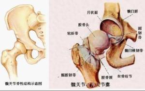 股骨头