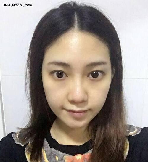 不够立体的鼻子,配上高颧骨,会显得脸看起来更大.