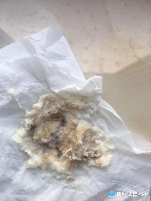 是不是胚胎一起流出来了呢,感觉是不是没希望了