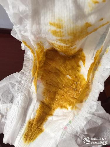我宝宝三个月这几天拉肚子了
