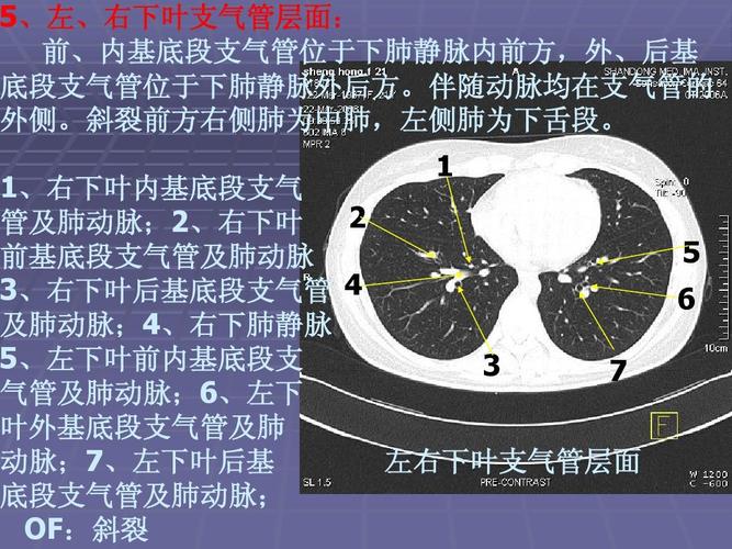 正常胸肺部ct影像学ppt
