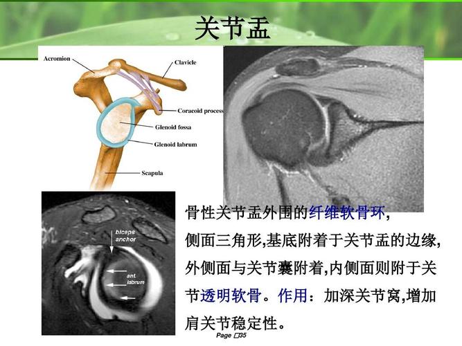 关节盂 骨性关节盂外围的纤维软骨环, 侧面三角形,基底附着于关节盂