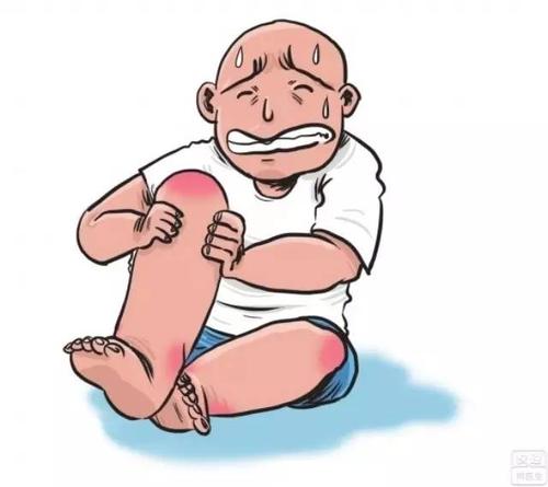 别以为痛风就是脚肿,脚疼那么简单!(后果沉痛)