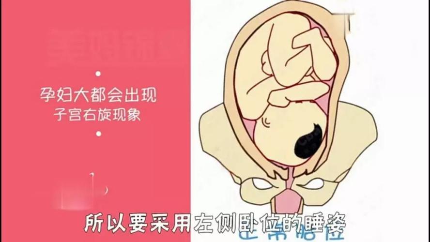 适合:左侧卧   胎儿的发育已经接近尾声,子宫会发生右旋的现象