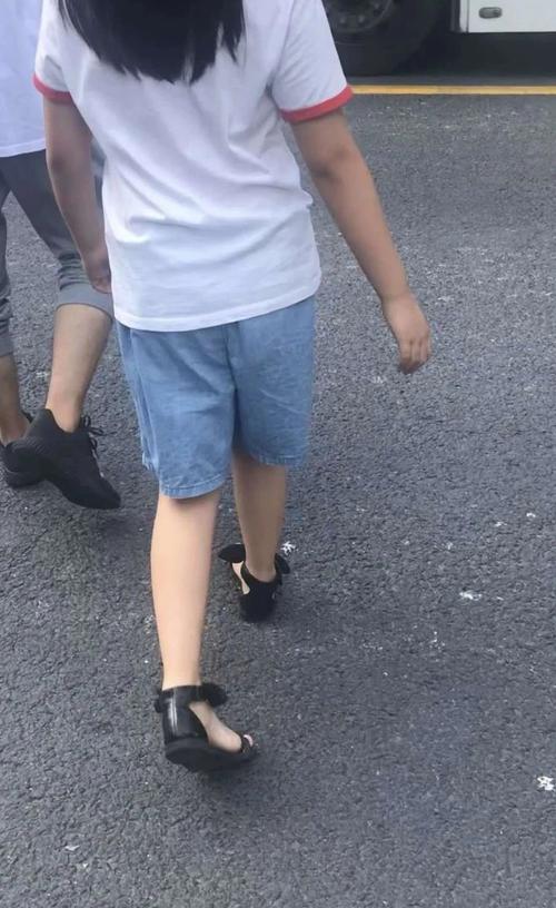 孩子"内八字"走路需要治疗吗?