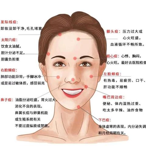 脸上不同位置长痘的原因