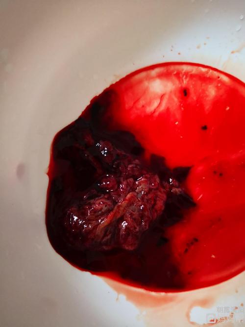 高龄,两个月左右自然流产两次,如何怀上健康聪明的宝宝?