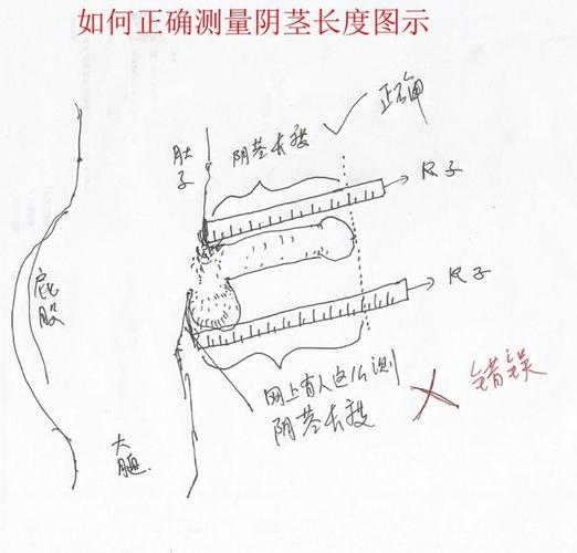 如何正确的测量丁丁长度?