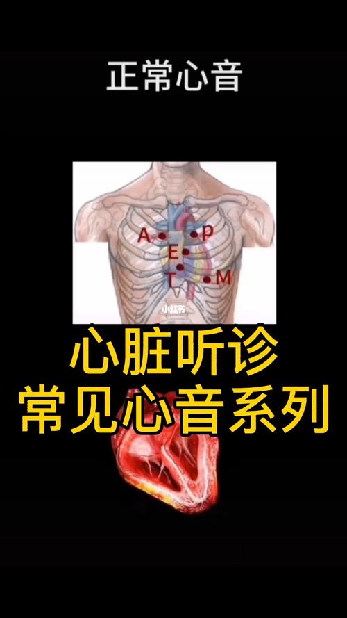 心脏听诊,常见心音系列分享_心肺训练_医疗健康_医疗