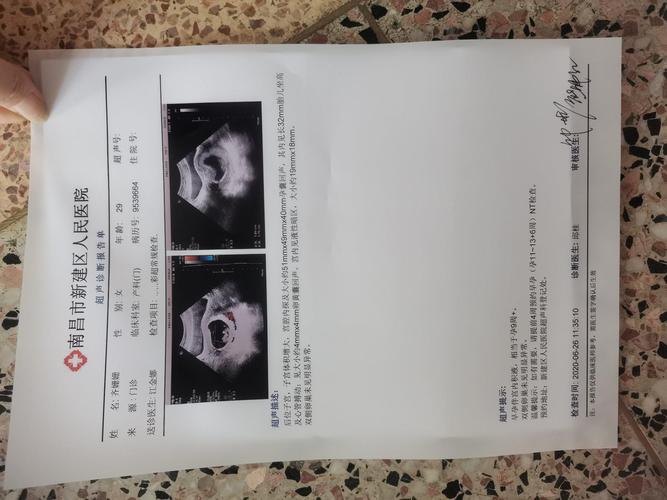 孕9周的照片出炉了