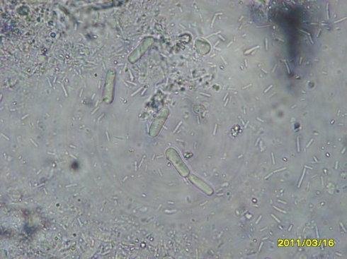 [转载]粪便中的真菌