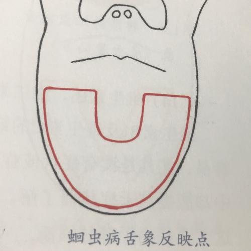 舌诊九区定位法