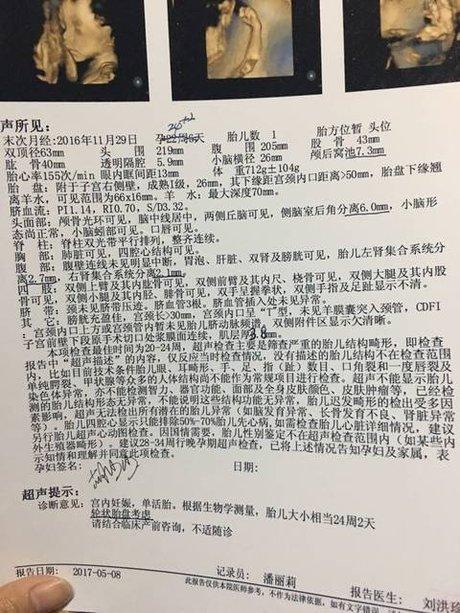 轮状胎盘