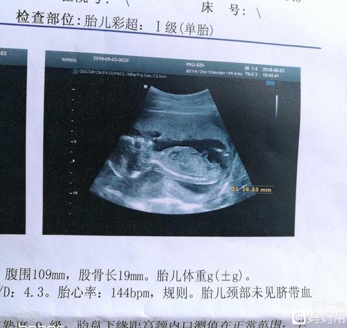 17周的胎宝宝也很可爱