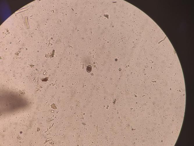 【讨论】这是蛔虫卵吗?有显微镜图