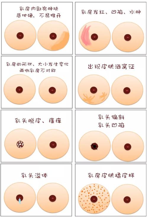 发现乳房肿块一定要手术吗?