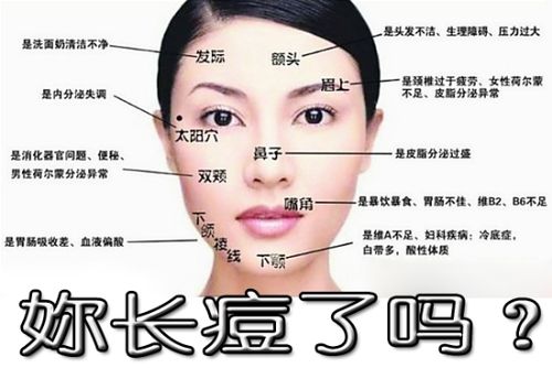 怎么去除痘痘?公开我的祛痘方法!