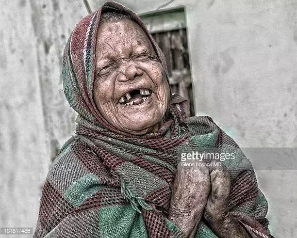 人类将麻风传染给犰狳,现在它们开始反杀爱吃野味的人类了