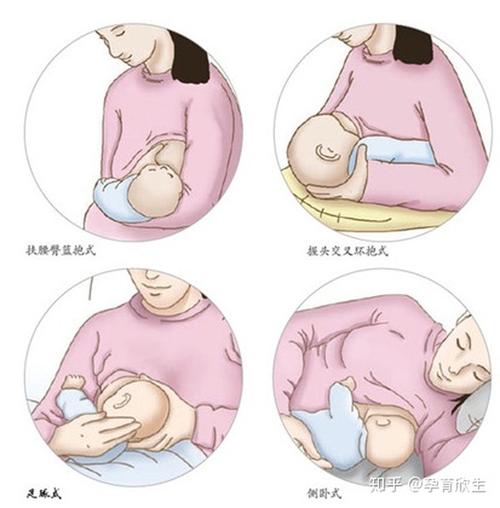 早吸吮,建立正确的衔乳姿势
