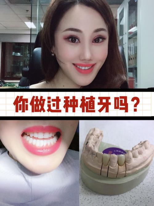 种植牙