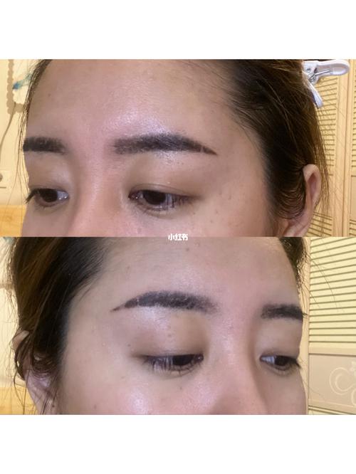 纹完眉没后悔,结痂让我慌了_纹眉_红薯_头屑_上色_美妆_医美整形