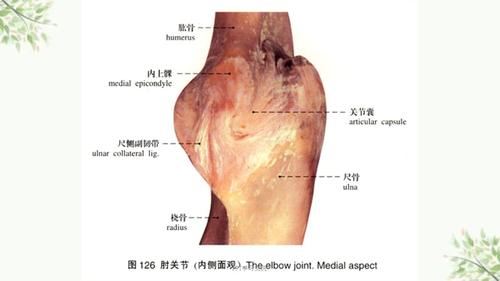 尺骨鹰嘴骨折课件