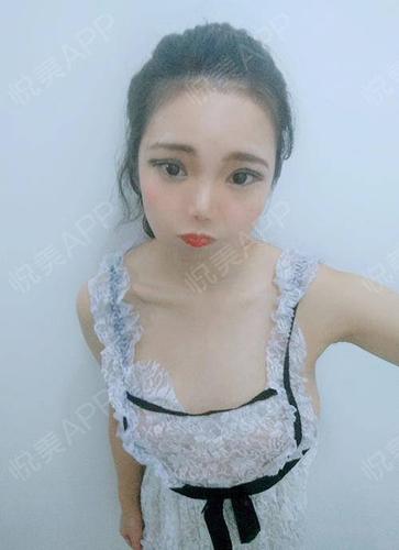 现在胸部恢复的挺不错的,胸部已经变软了不少,伤口的疤痕也变的淡淡的