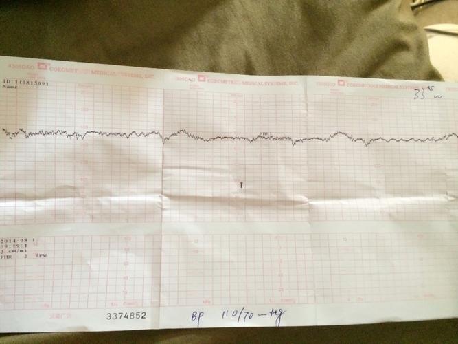 马志峰 医师 我现在31周1天了,胎动特别频繁,四天前我做了一次胎心