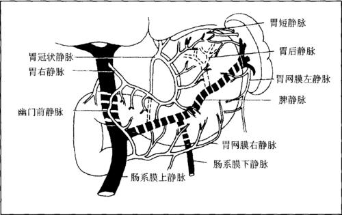 消化道穿孔其实也算的上是一种比较常见的疾病,而胃穿孔更是消化道